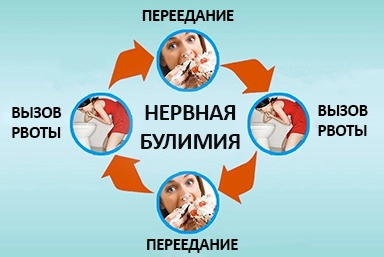 Лечение булимии в Гиагинской